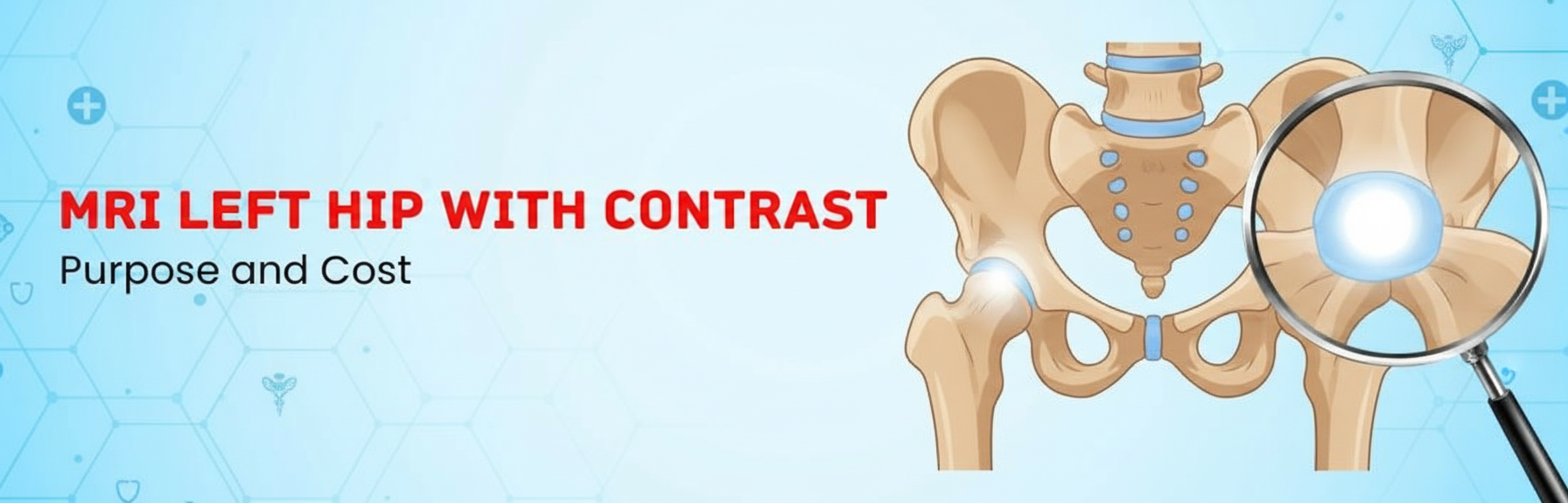 MRI Left Hip With Contrast: Purpose and Cost in Delhi